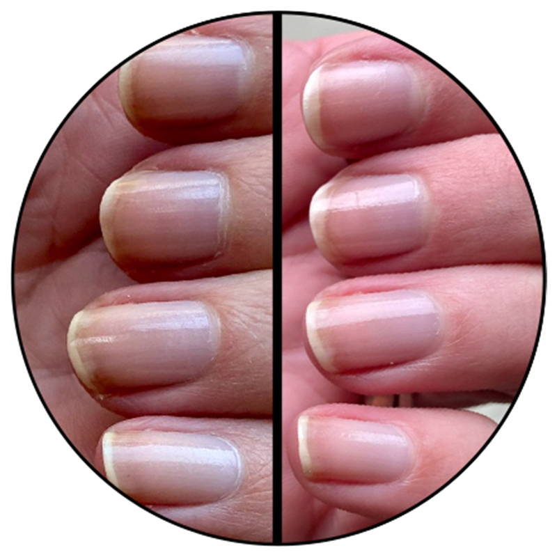 Nail Hardener - Image 2